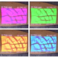 Enmind VV-100 Vein Viewer