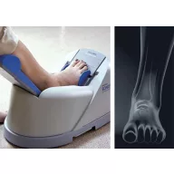 OsteoSys SONOST-2000 ultradźwiękowy densytometr kości BMD
