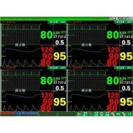   Contec CMS Central Monitoring System V3.0 Central Monitoring System PC Software