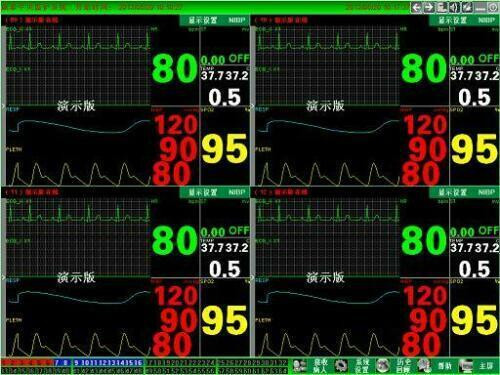 Contec CMS Central Monitoring System V 3.0 központi felügyeleti Rendszer PC szoftver Contec betegellenőrző monitorokhoz, 64 helyes