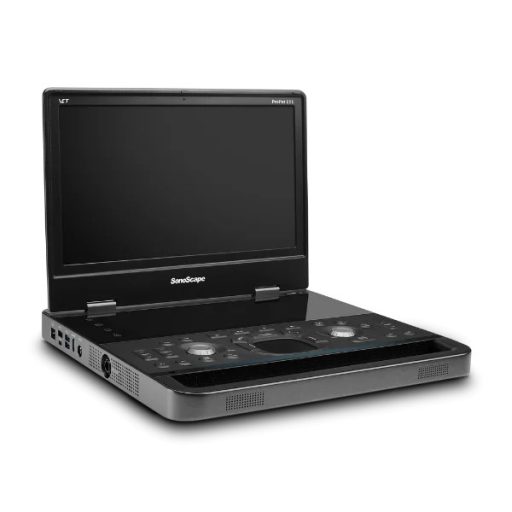 SonoScape E11 portable ultrasound device