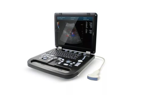 Contec CMS1700C portable color ultrasonic scanner diagnostic system, color doppler + probe