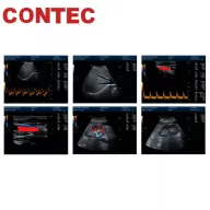   Contec CMS1700C tragbares Farb-Ultraschall-Diagnosesystem, Farbdoppler + Sonde