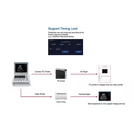   Contec CMS1700C tragbares Farb-Ultraschall-Diagnosesystem, Farbdoppler + Sonde