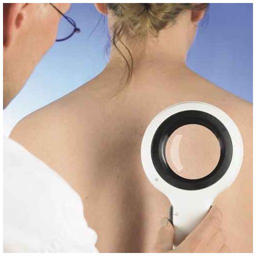 DermLite Lumio, Vergrößerungslicht Dermatoskop LED