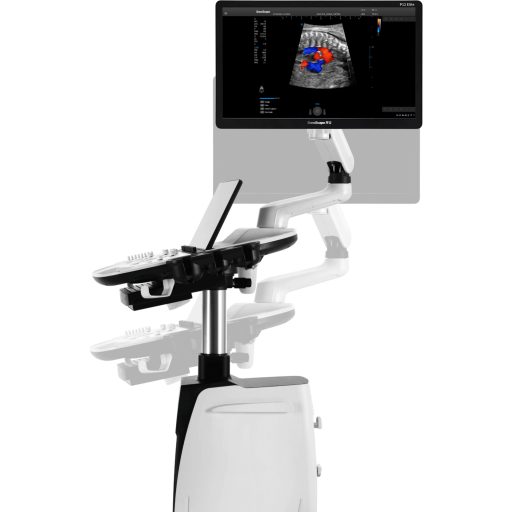 SonoScape P12 Elite ultrasound device