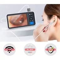   Otoscope Ear Endoscope, Ear Cleaner Tool With Rechargeable Battery