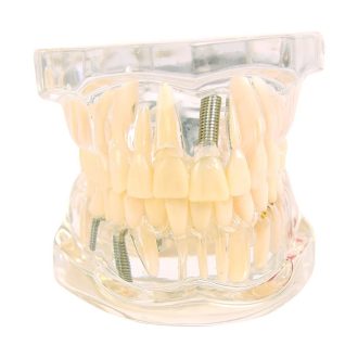 Transparent jaw model | adult teeth