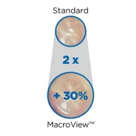 MacroView™ Prestige™ LED Otoscope Set