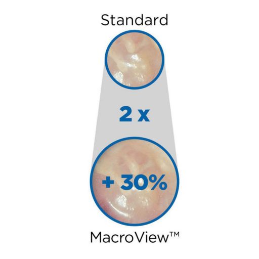Zestaw otoskopowy MacroView™ Prestige™ LED