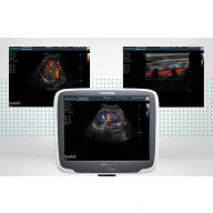 SonoScape S11 Plus Ultraschallsystem