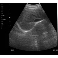   CONTEC CMS 1600B VET dwusondowy system diagnostyki ultrasonograficznej z kolorowym Dopplerem 32 kanałowa sonda akumulatorowa wypukła i liniowa