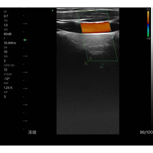 CONTEC CMS 1600B VET dwusondowy system diagnostyki ultrasonograficznej z kolorowym Dopplerem 32 kanałowa sonda akumulatorowa wypukła i liniowa