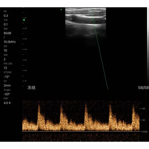 CONTEC CMS 1600B VET dwusondowy system diagnostyki ultrasonograficznej z kolorowym Dopplerem 32 kanałowa sonda akumulatorowa wypukła i liniowa