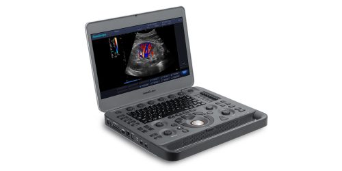 Sonoscape X3 portable ultrasound device