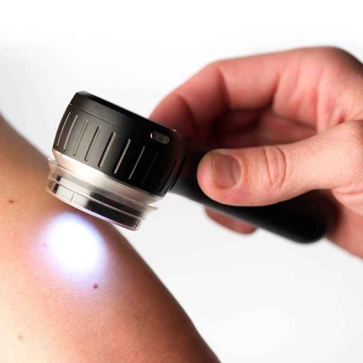 DermLite DL4W Dermatoscope