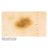 HEINE DELTA 30 PRO Dermatoscope