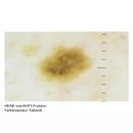 HEINE DELTA 30 PRO Dermatoscope
