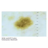 HEINE DELTA 30 PRO Dermatoscope
