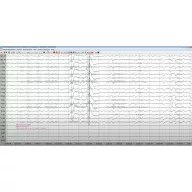   Contec 24 channel KT88-2400 EEG Digital Brain Electric Activity Mapping with software