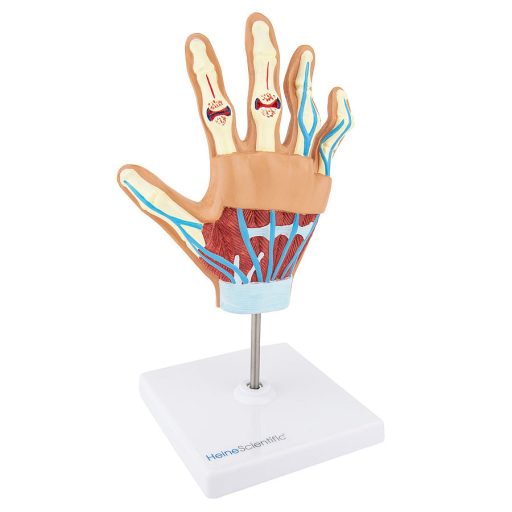 Rheumatoid arthritis model