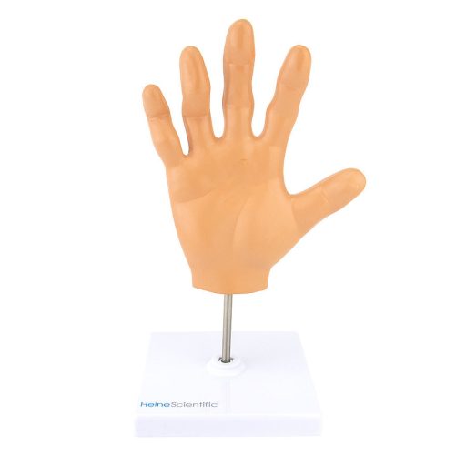 Rheumatoid arthritis model