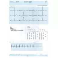 InnoBase ECG software for Windows