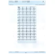 InnoBase ECG software for Windows