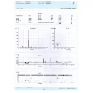 InnoBase ECG software for Windows