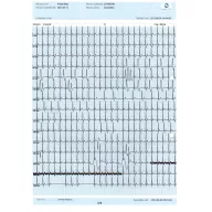 InnoBase ECG software for Windows