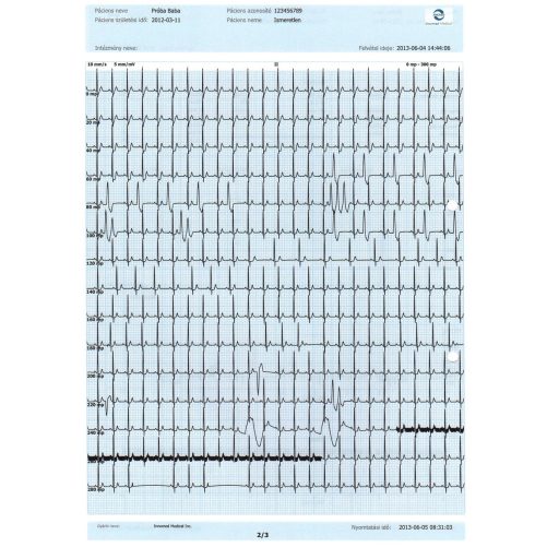 InnoBase ECG software for Windows