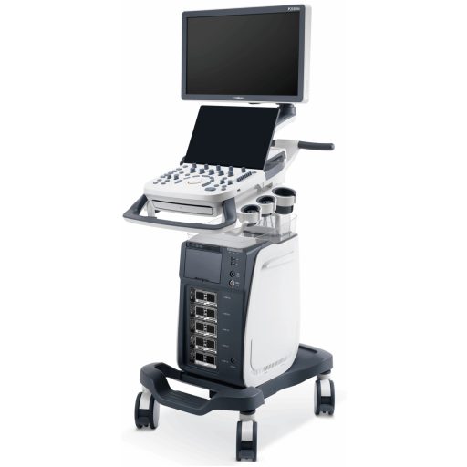 SonoScape P20 Elite ultrasound device