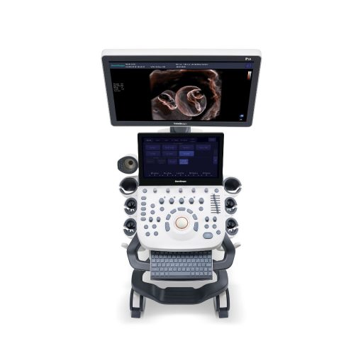 SonoScape P20 Elite ultrasound device