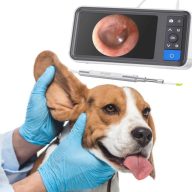   Otoscope Ear Endoscope, Ear Cleaner Tool With Rechargeable Battery