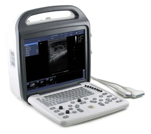 DC10 ultrasound with 15" LCD monitor and li-Battery 