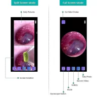 Digital otoscope LUX with wireless app