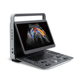   Sonoscape E2V Color Doppler Veterinary Ultrasound System with linear probe L741, convex probe 3C-A, and suitcase