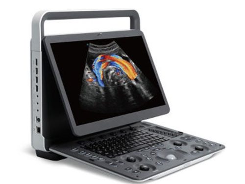 Weterynaryjny diagnostyczny system ultrasonograficzny Sonoscape E2V Color Doppler