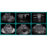   Sonoscape E2V Farb-Doppler-Ultraschallsystem für Veterinäranwendungen mit Linearsonde L741, konvexer Sonde 3C-A und Koffer