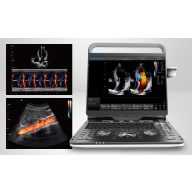 CHISON EBit 60 Ultraschallsystem