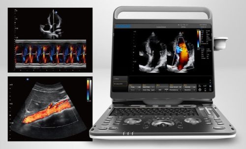 System ultrasonograficzny EBit 60 firmy CHISON
