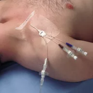   Tegaderm™ transparent film dressing, central cannula recorder 1626W