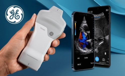 Vscan Air™ SL Ultrasound System