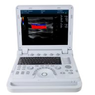  Contec CMS1700B tragbares Farb-Ultraschall-Diagnosesystem, Farbdoppler + Sonde