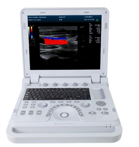 Contec CMS1700B portable color ultrasonic scanner diagnostic system, color doppler + probe