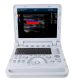 Contec CMS1700B tragbares Farb-Ultraschall-Diagnosesystem, Farbdoppler + Sonde