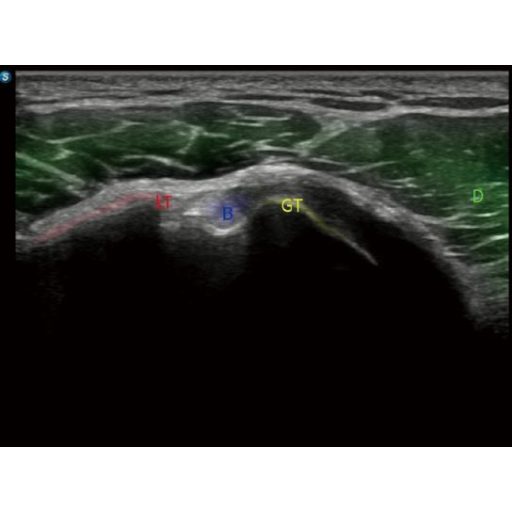 SonoScape S80 Elite Ultrasound System