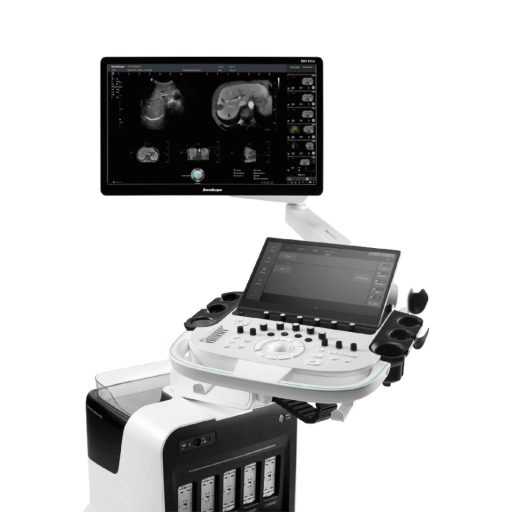 SonoScape S80 Elite Ultrasound System