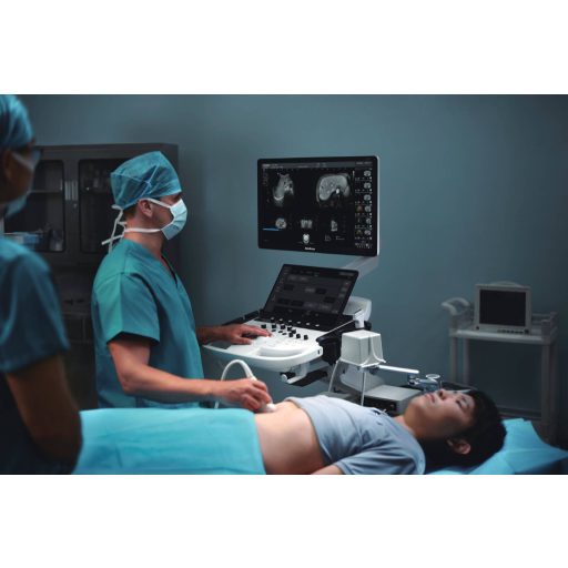 SonoScape S80 Elite Ultrasound System