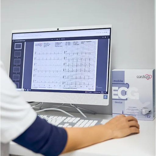 CardioNS - medyczne spoczynkowe 12-kanałowe urządzenie EKG